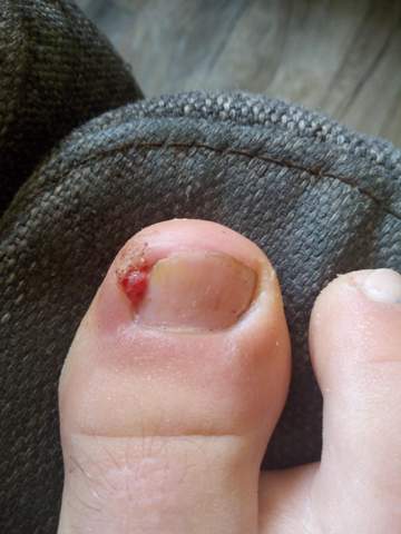 Was Ist Das Gesundheit Zehnagel Was Ist Das Gesundheit Zehnagel