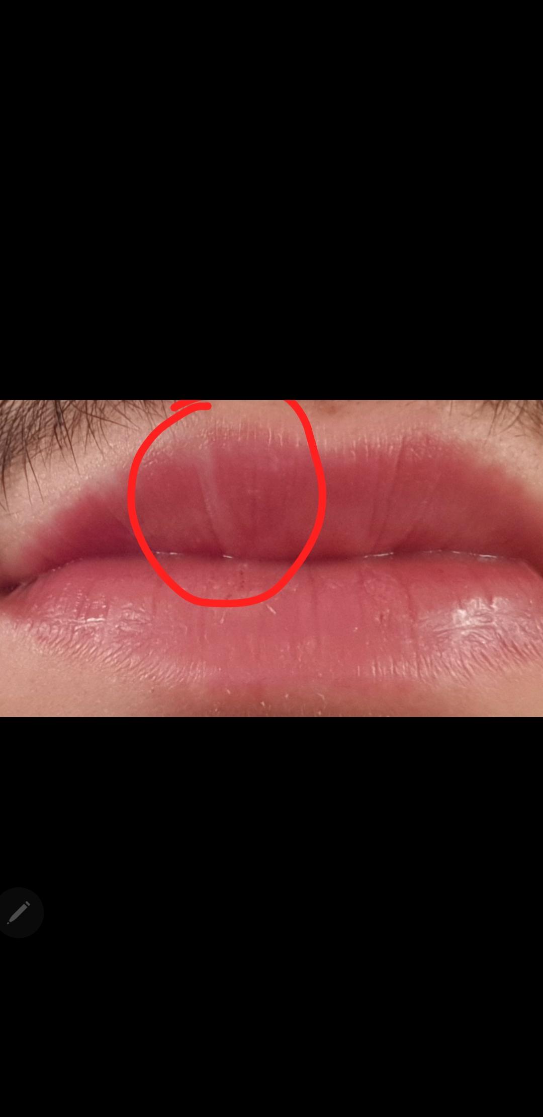 Was Ist Das Biologie Gesicht Lippe