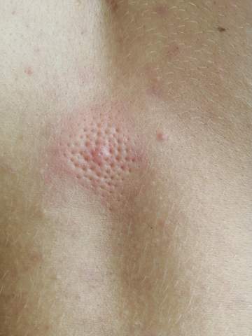 Was Ist Das Gesundheit Rucken