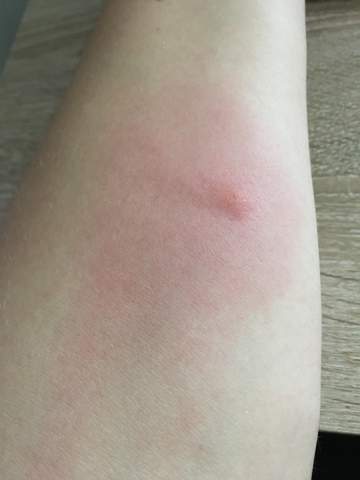 - (Haut, Hautpflege)