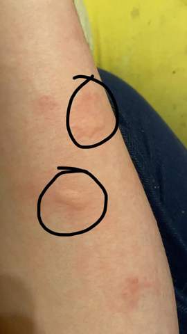 Was ist das? (Medizin, Haut)