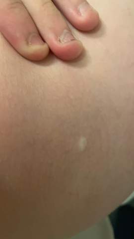 Was Ist Das Gesundheit Und Medizin Flecken Was Ist Das Gesundheit Und Medizin Flecken