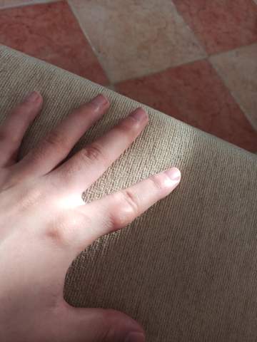 Was ist das? (Gesundheit und Medizin, Hand, Finger)