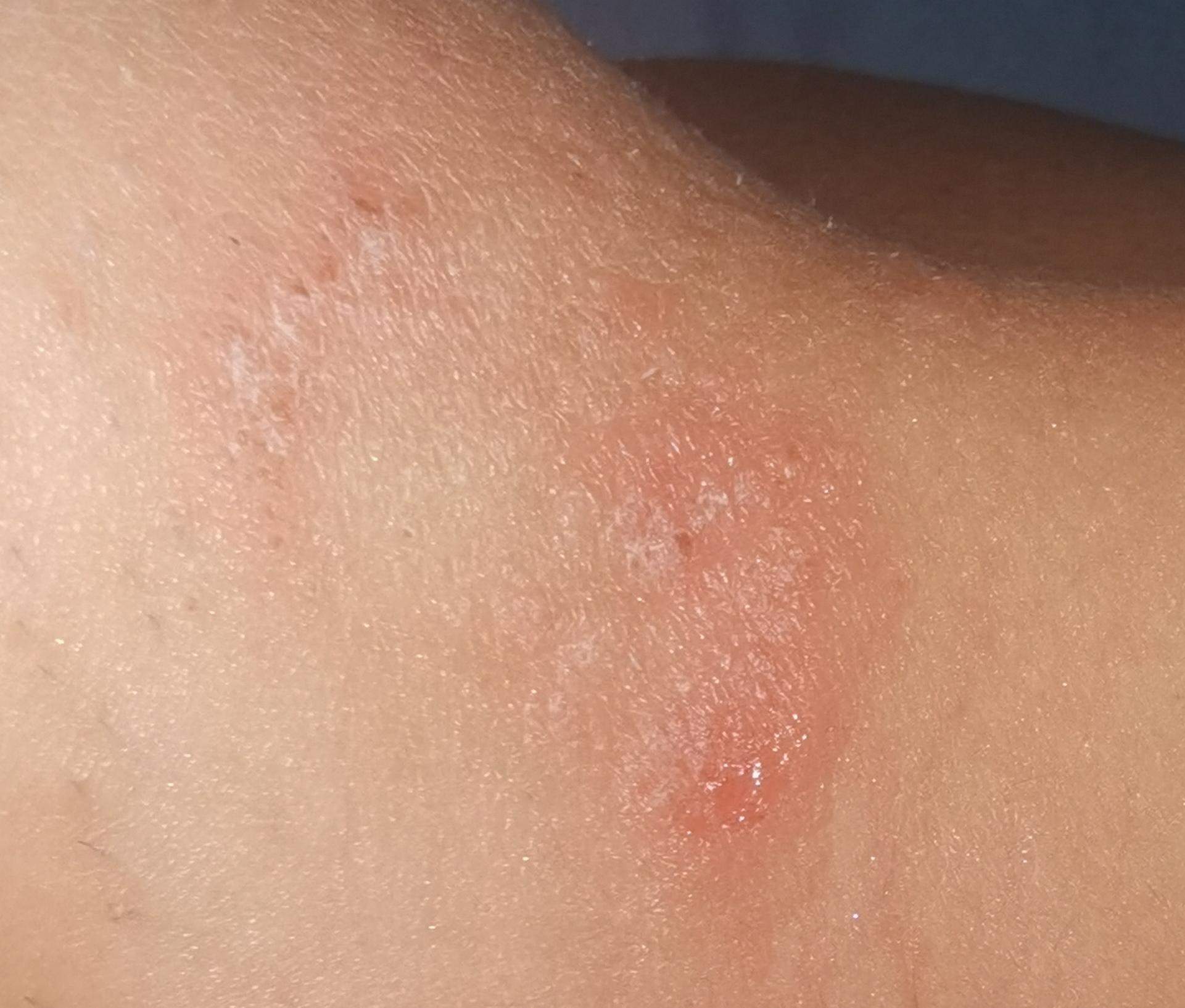 Was ist das? (Gesundheit und Medizin, Intimbereich, Irritation)