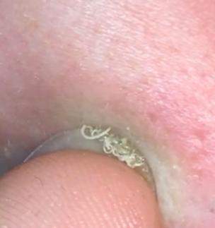 Was ist das? (Haut, Pickel, Pflege)