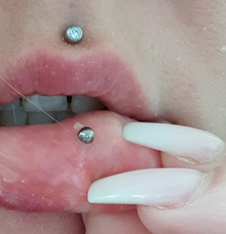 was ist das am ashley piercing wildfleisch gesundheit und medizin lippenpiercing