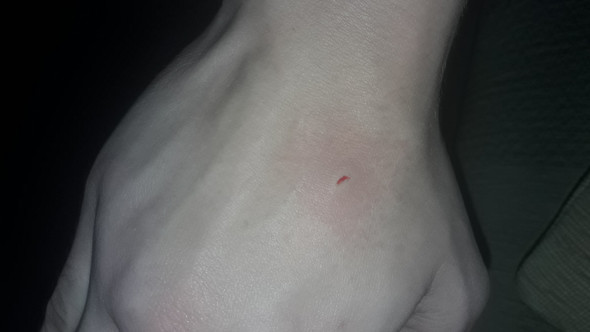 Die stelle - (Gesundheit, Sport, Blut)