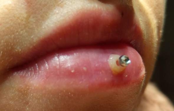 was ist das an meinem ashley piercing piercer lippenpiercing piercingschmuck