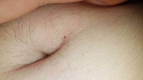 Was Ist Das An Meinem Bauchnabel Was Ist Das An Meinem Bauchnabel
