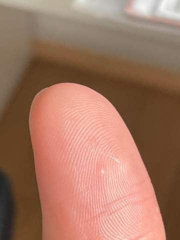 Was ist das an meinem Finger?