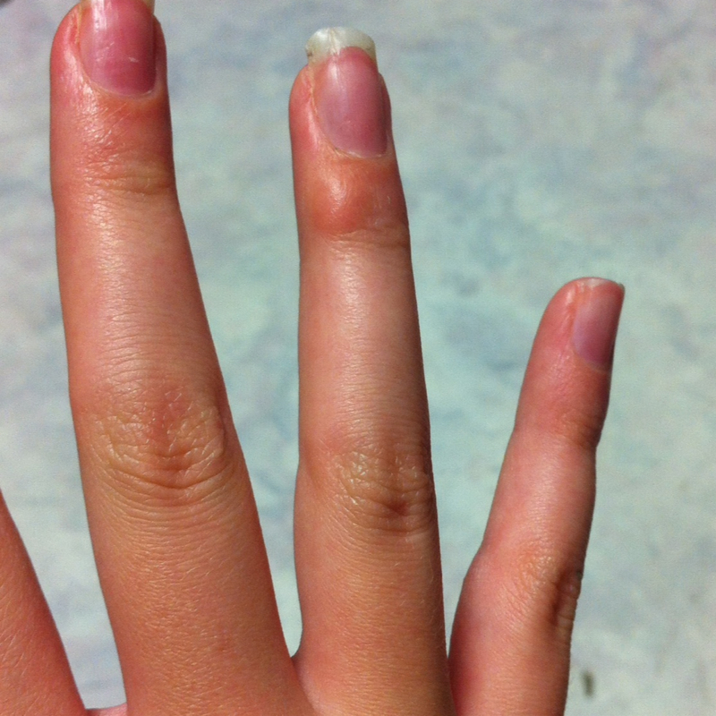 Was ist das an meinem Ringfinger? (Finger, Knochen)