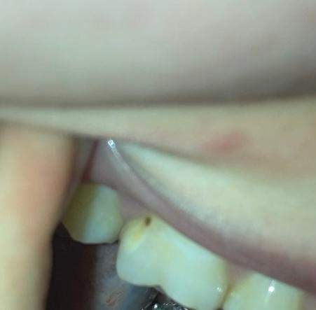 Was ist das an meinem Zahn?