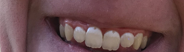 Zahnfoto - (Gesundheit und Medizin, Zähne, Zahnarzt)