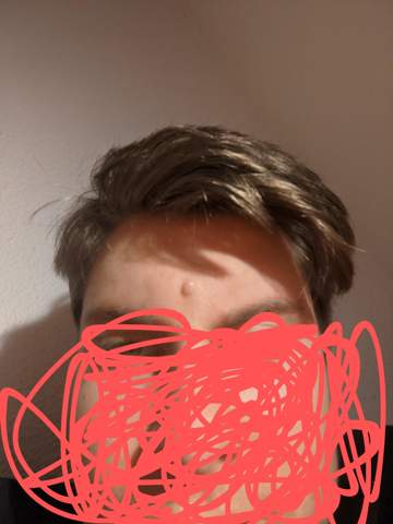 Was ist das an meiner stirn?