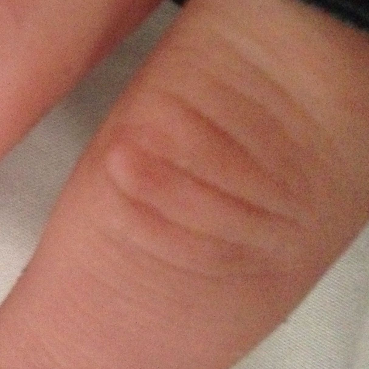 pickel an hand pickel an hand