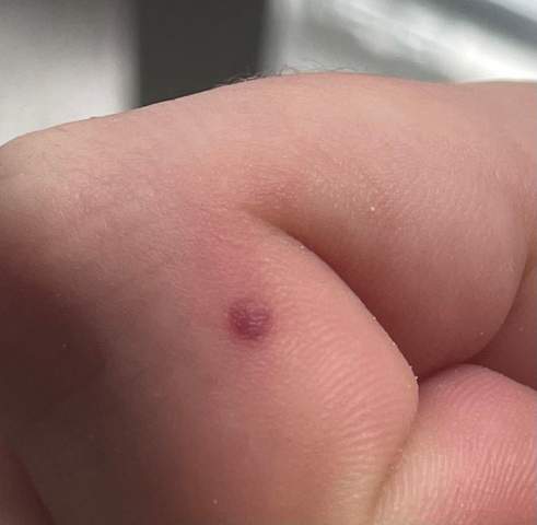 Was ist das auf meinem Finger?
