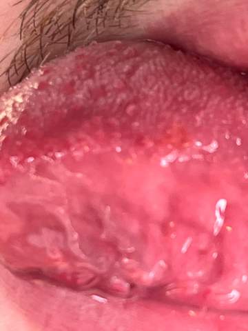 Was ist das auf meiner Zunge?