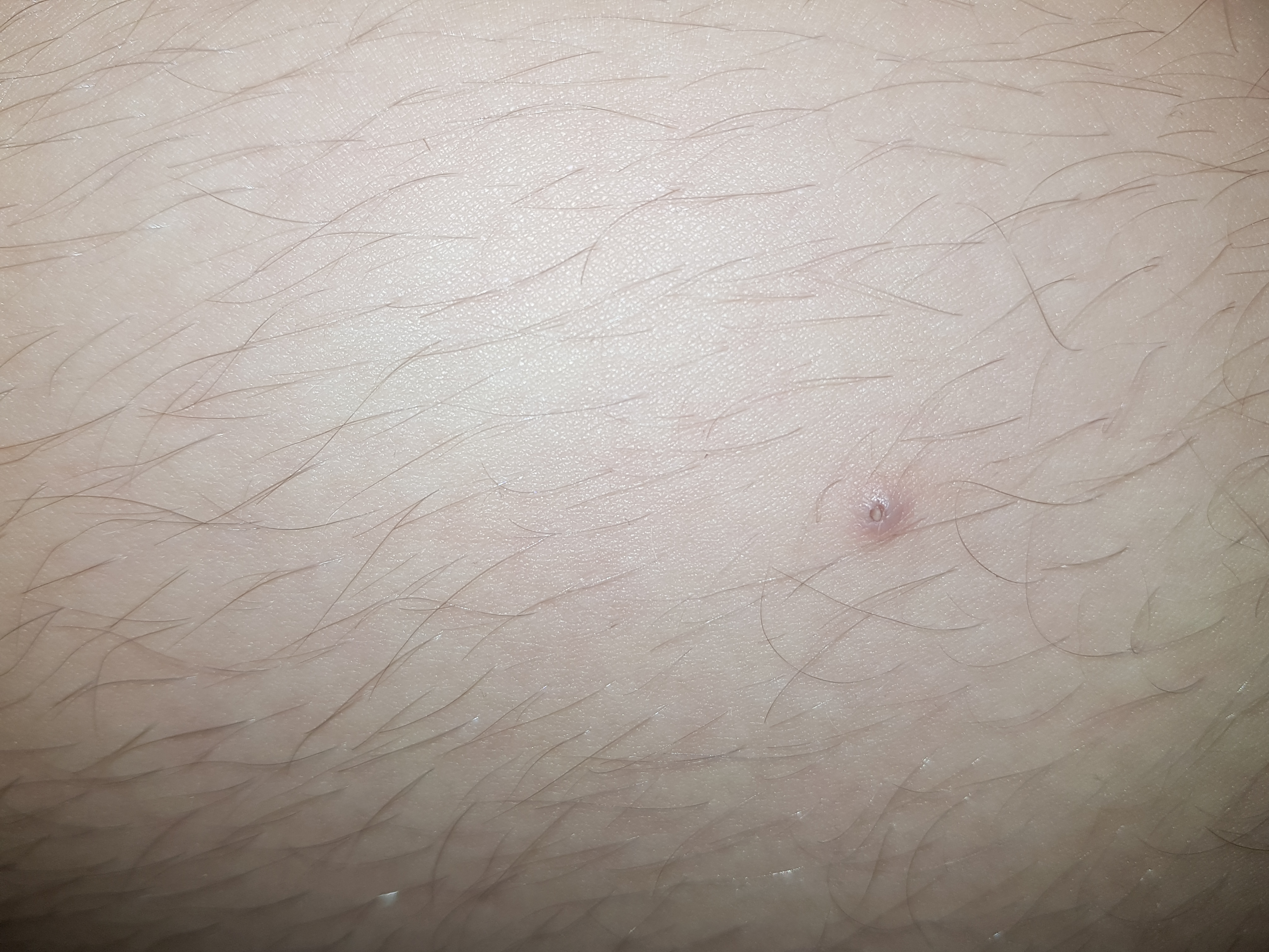 was ist das bei der obere bein