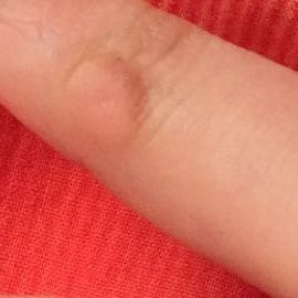 ....... - (Finger)