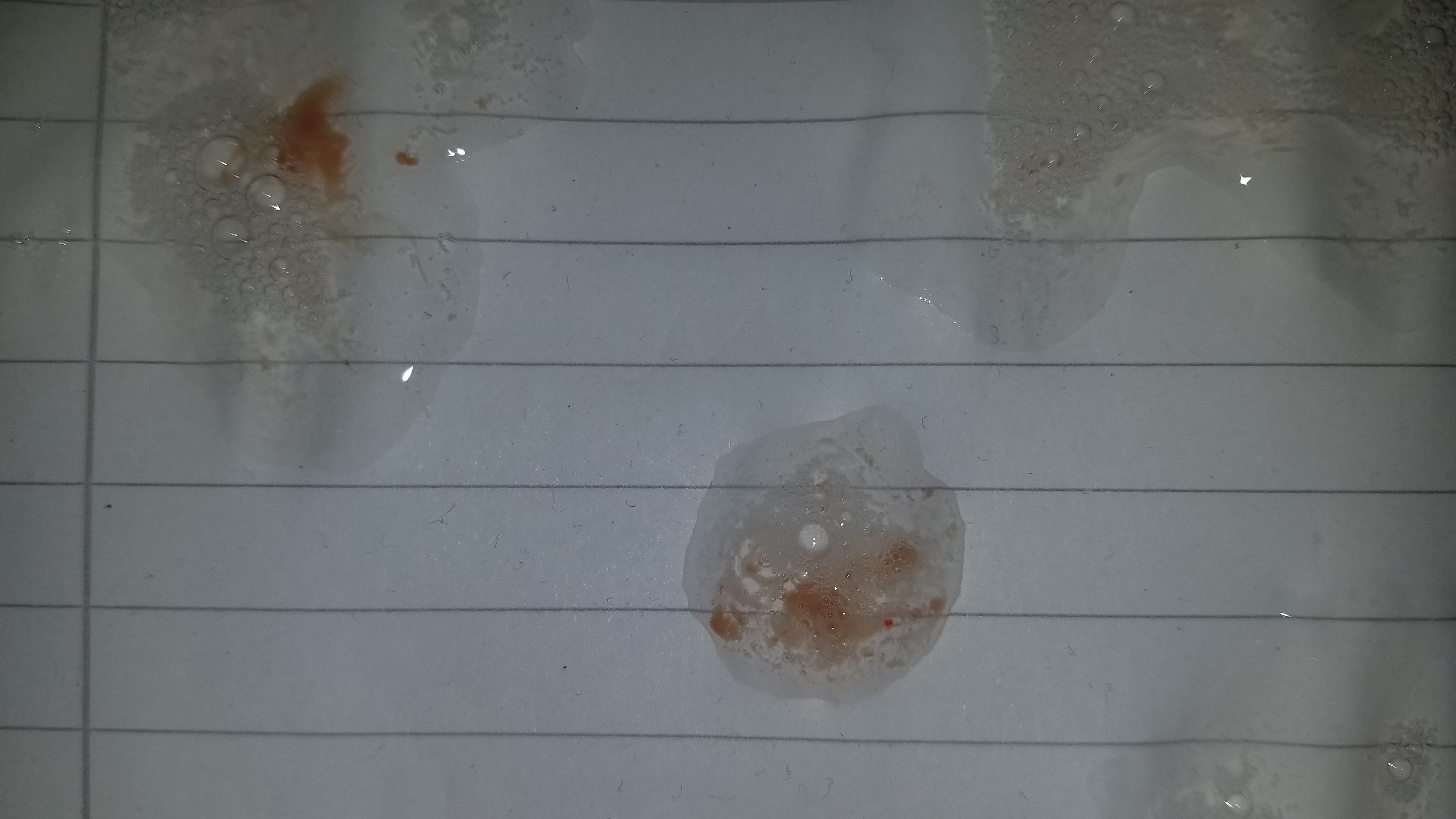 Was Ist Das Fur Auswurf Gesundheit Und Medizin Gesundheit Arzt Was Ist Das Fur Auswurf Gesundheit Und Medizin Gesundheit Arzt