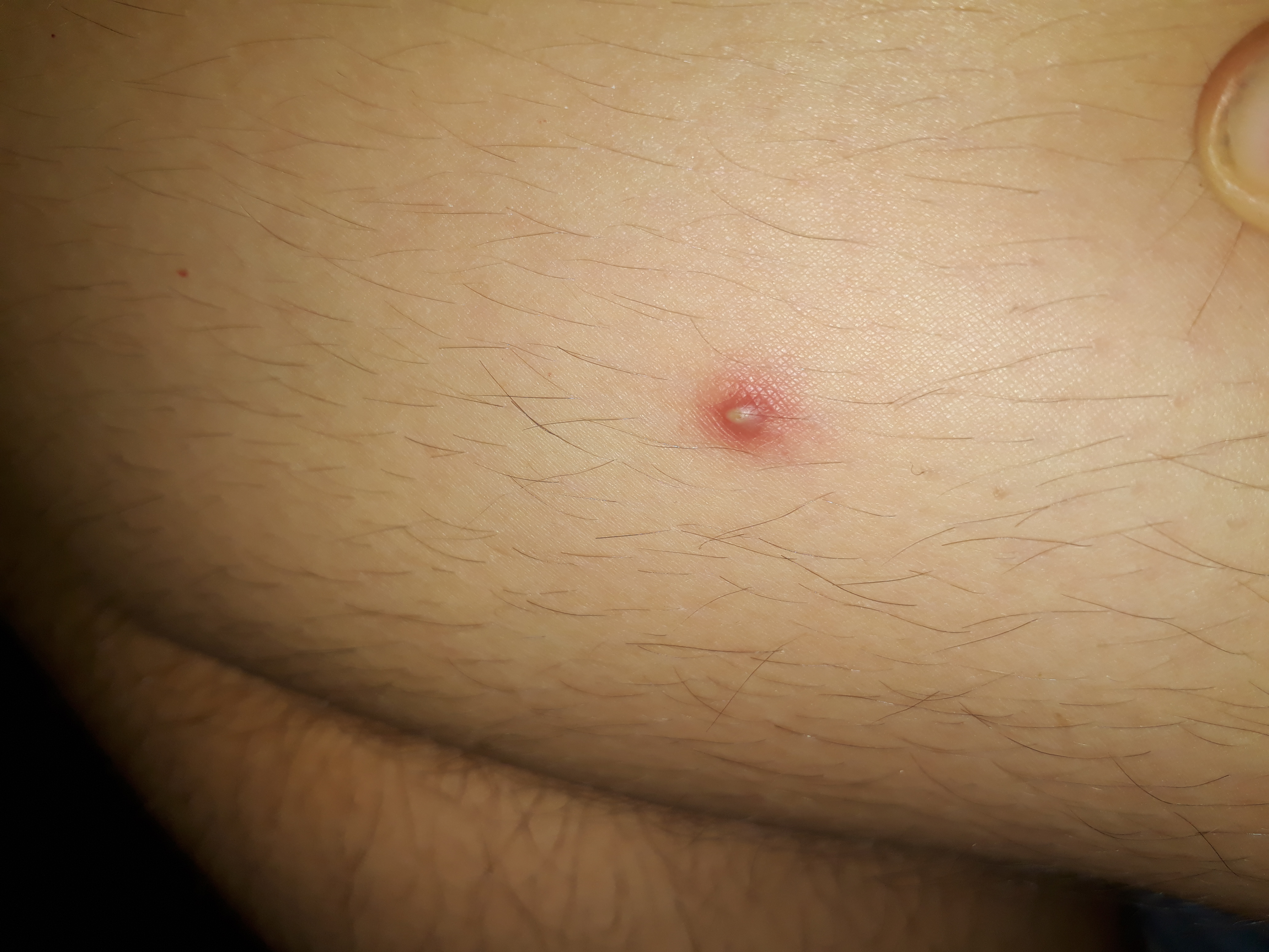 was ist das fur ein ding an meinem bein