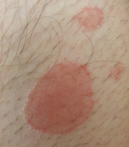 - (Gesundheit, Medizin, Arzt)