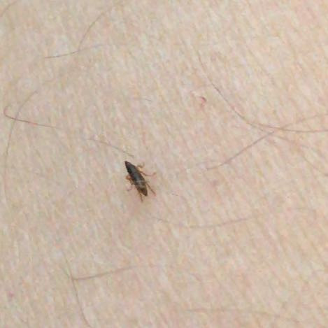 Was Ist Das Fur Ein Kleines Mieses Insekt Gesundheit Und Medizin Insekten Ausschlag