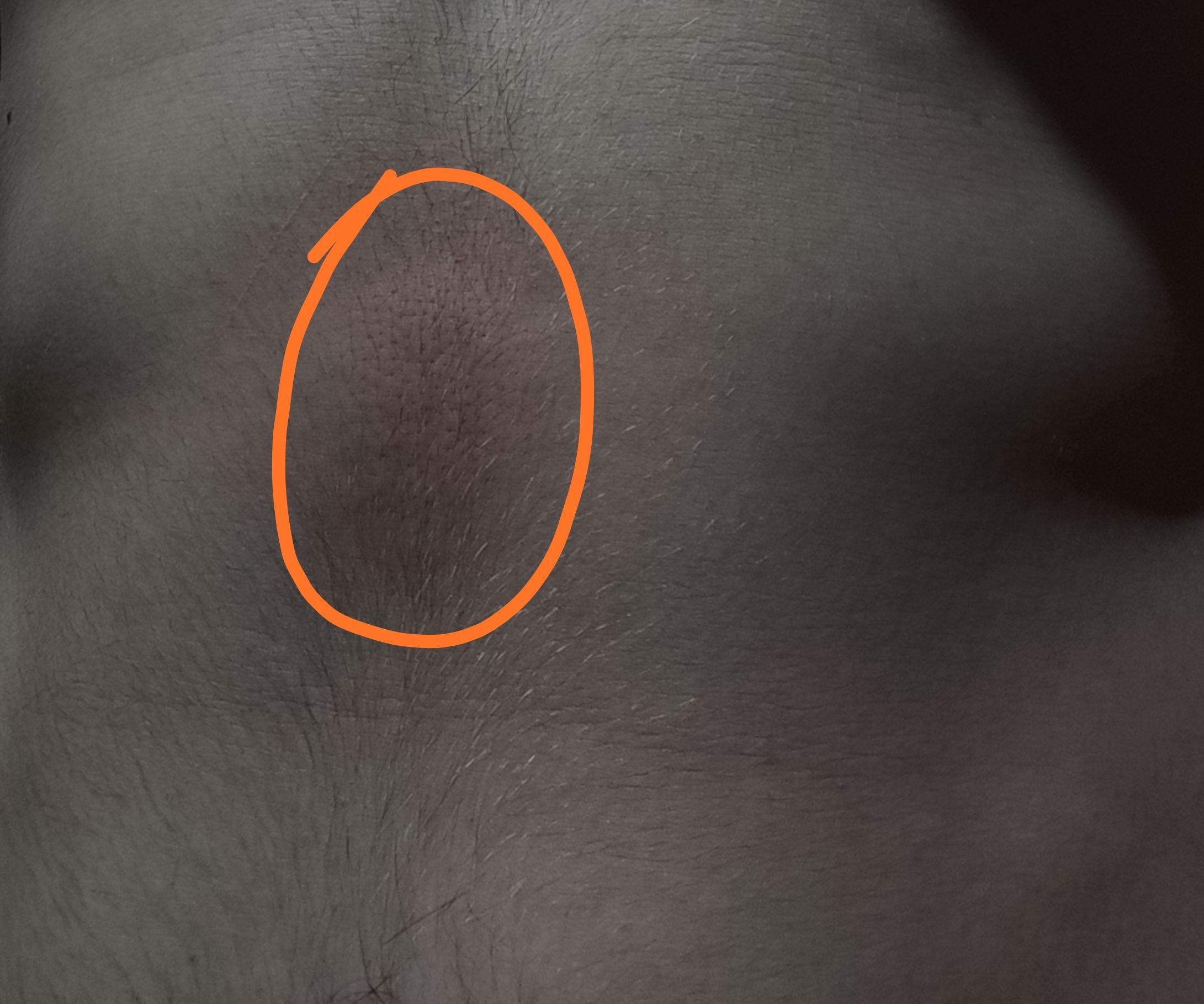 Was ist das für ein Knoten auf/unter dem Bauch? (Gesundheit und Medizin