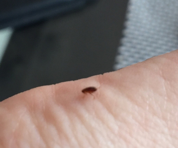 Springendes Insekt Was ist das für ein springendes Tier? (Natur, Insekten)