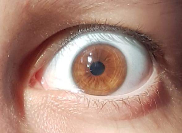 Was ist das für eine Augenfarbe?