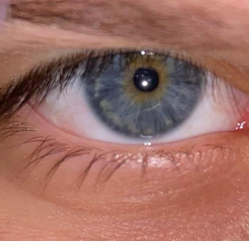 Was ist das für eine Augenfarbe? Ist das einfach nur blau?