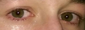 Augen - (Körper, Augen)