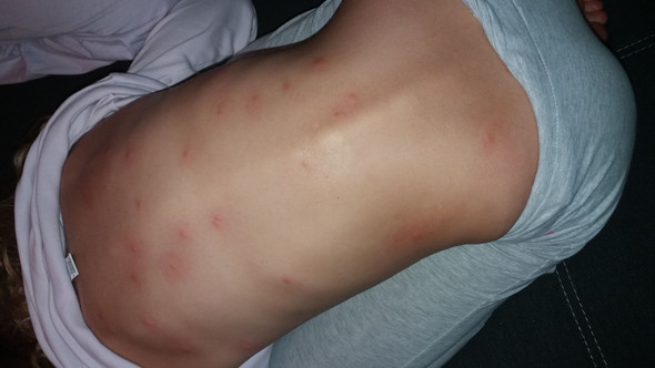 - (Gesundheit, Medizin, Krankheit)