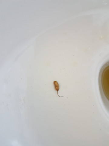 Was Ist Das Fur Eine Larve In Der Toilette Tiere Badezimmer Larven Was Ist Das Fur Eine Larve In Der Toilette Tiere Badezimmer Larven