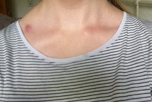 Was Ist Das Haut Medizin Gesundheit Und Medizin Fibromyalgie Was Ist Das Haut Medizin Gesundheit Und Medizin Fibromyalgie