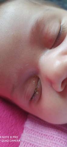 Was Ist Das Im Auge Meiner Tochter Augen Baby Augenarzt