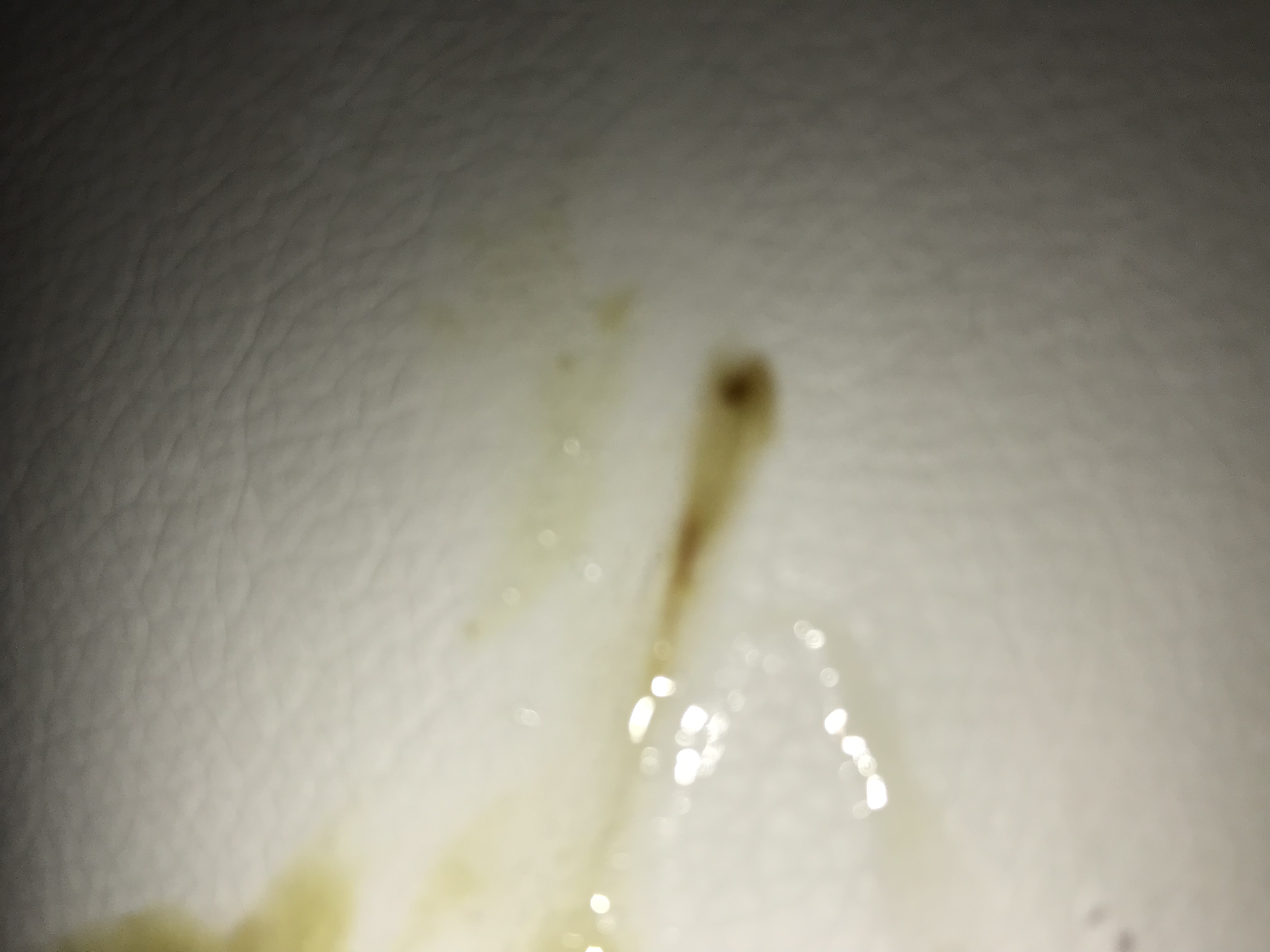 Blut Im Schleim Beim Spucken www.gutefrage.net