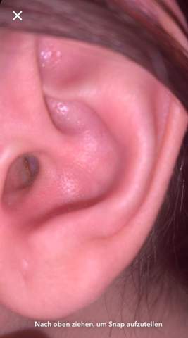 Was Ist Das In Meinem Innen Ohr Gesundheit Und Medizin Innenohr Was Ist Das In Meinem Innen Ohr Gesundheit Und Medizin Innenohr