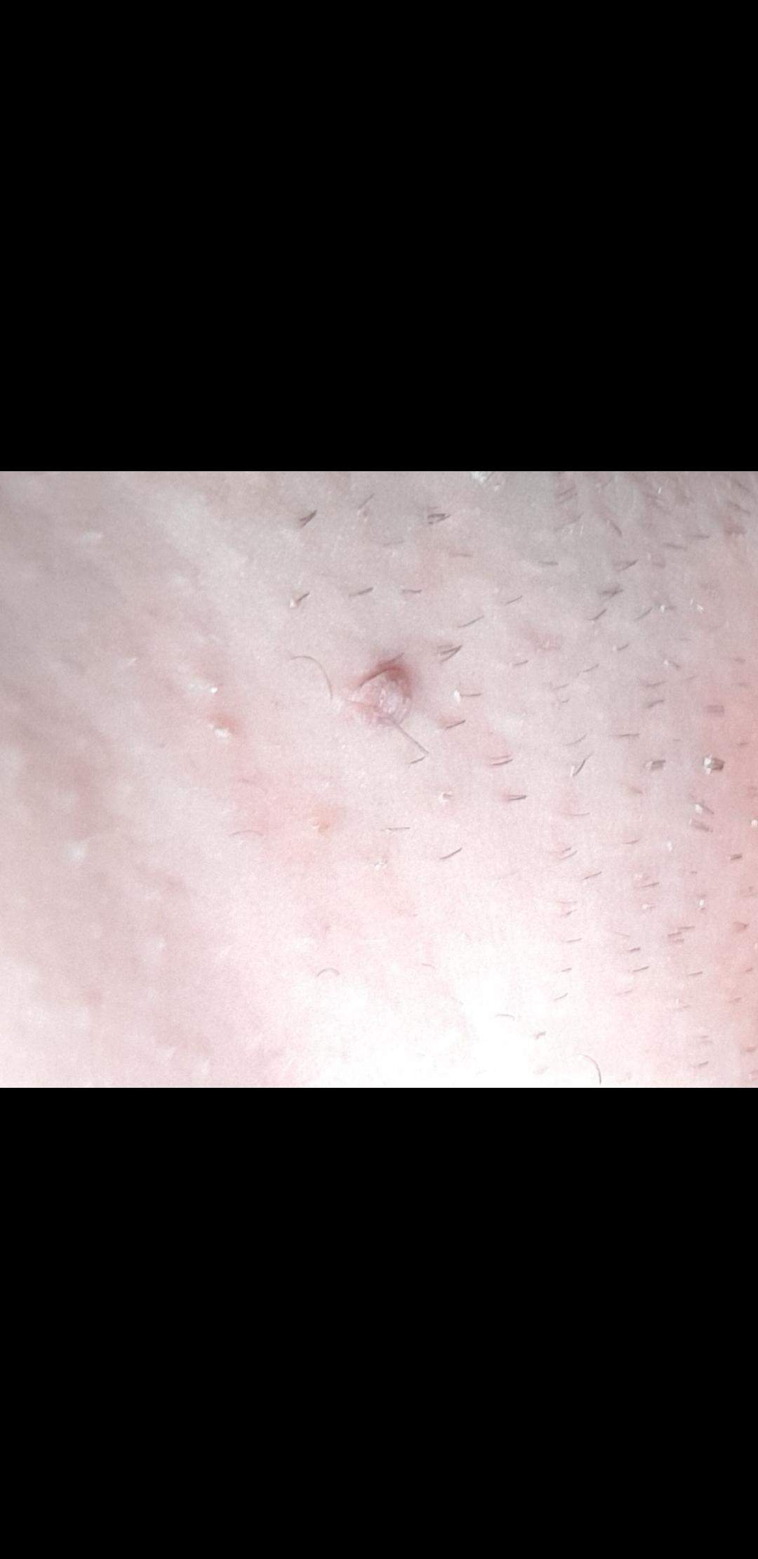 Was ist das in meinem Intimbereich? (intim)