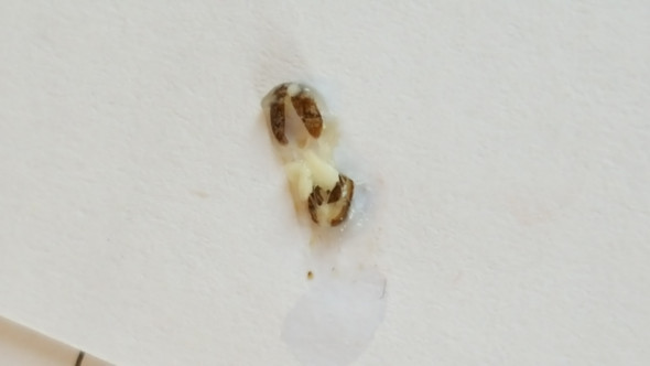 Nach dem "Knacken" - (Mund, Parasiten)