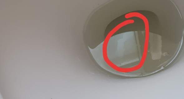 Was Ist Das In Meinem Urin Gesundheit Und Medizin Gesundheit Manner Was Ist Das In Meinem Urin Gesundheit Und Medizin Gesundheit Manner