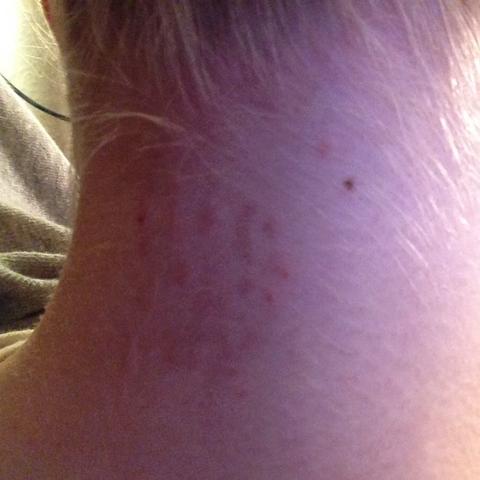 Was Ist Das In Meinen Nacken Medizin Arzt Krank Was Ist Das In Meinen Nacken Medizin Arzt Krank