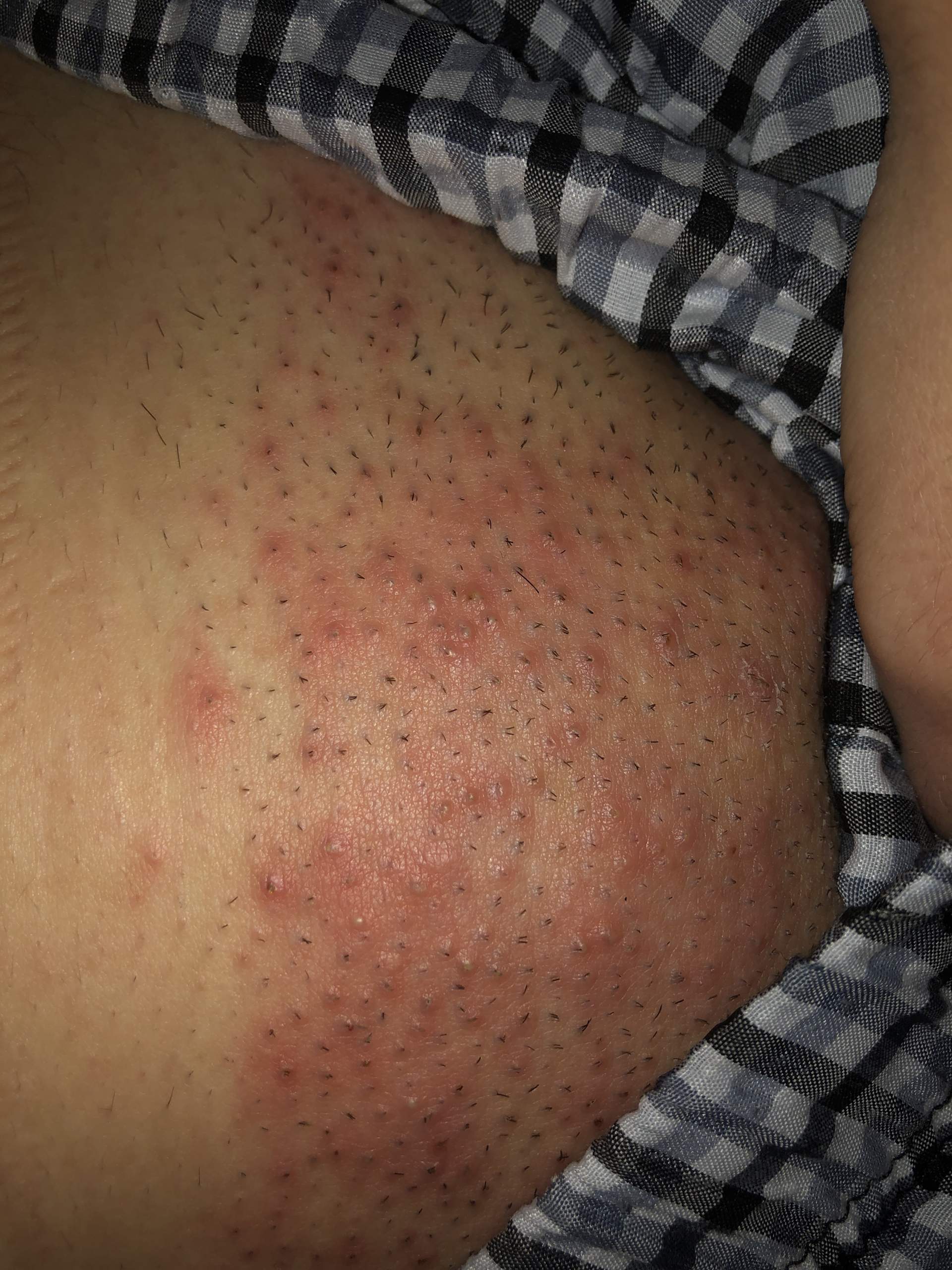 Was ist das kann mir das jemand sagen? Scheidenpilz? (Scheide Was ist das kann mir das jemand sagen? Scheidenpilz? (Scheide