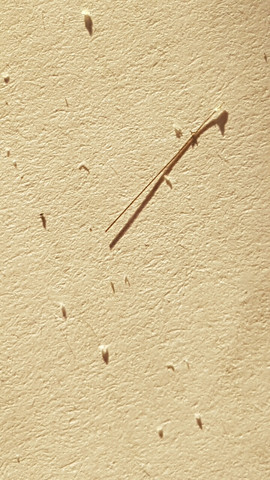 was ist das lause haare