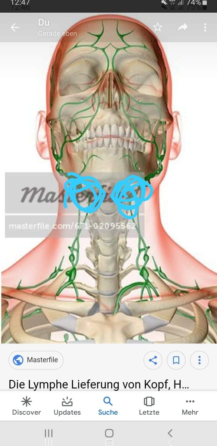 Am hals wo sind lymphknoten Vergrößerte Lymphknoten