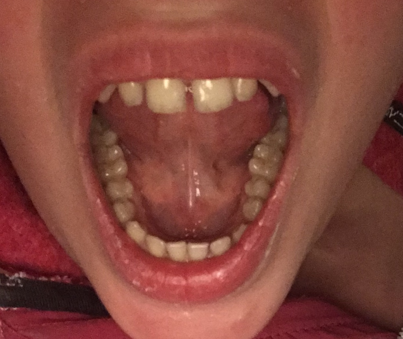 Was ist das unter meiner Zunge Hilfe ? (Gesundheit und Medizin)