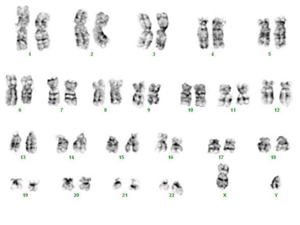 Zerteilte Chromosomen - (Gesundheit, Menschen, Biologie)