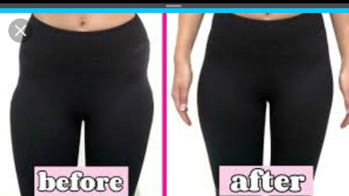 Wie Bekomme Ich Hip Dips Weg