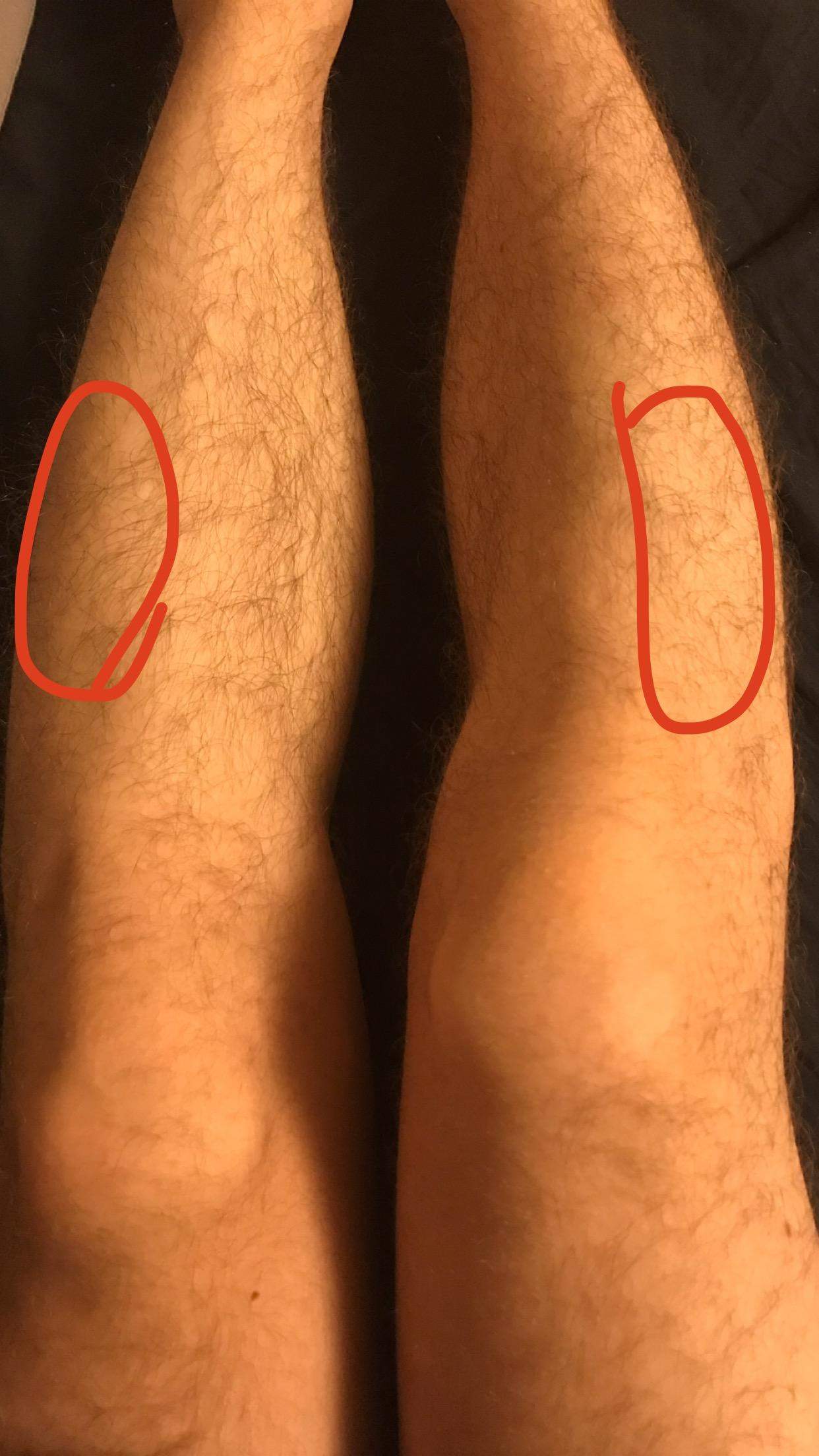 Was Ist Die Ursache Fur Die Schmerzen In Meinen Beinen Gesundheit Und Medizin Gesundheit Was Ist Die Ursache Fur Die Schmerzen In Meinen Beinen Gesundheit Und Medizin Gesundheit