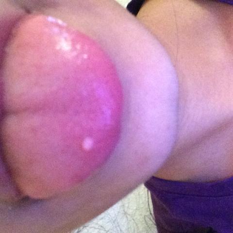 46+ Pickel Auf Der Zunge Schmerzen Pics